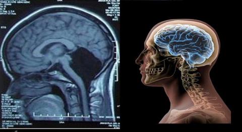 اكتشاف بصمة فريدة للرأس تتفوق على الإصبع