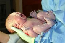 دراسة تحذر من الولادة القيصرية